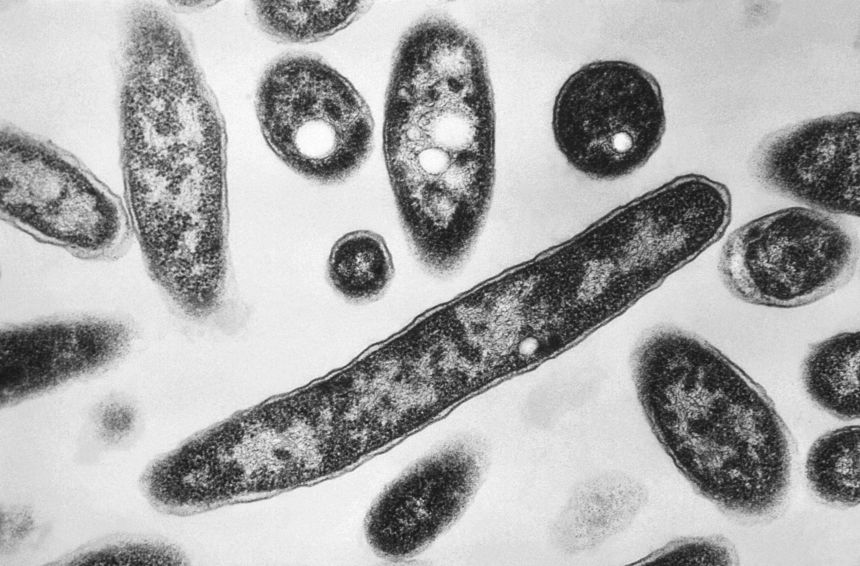 Dozens of New York cooling towers test positive for Legionnaires’ bacteria as outbreak reaches 63 cases