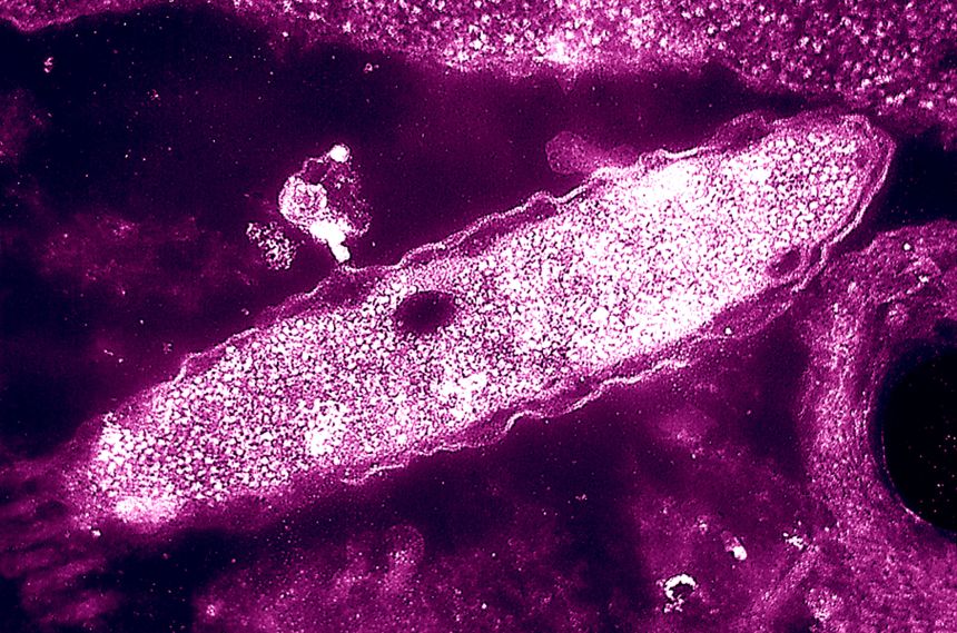 Four deaths reported in New York City Legionnaires’ disease cluster