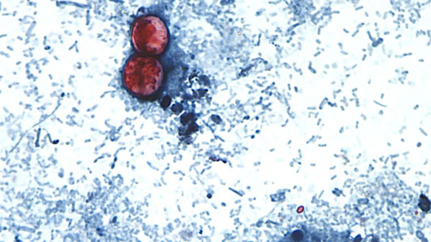 Diarrhea-causing parasite that can contaminate raw produce causing misery across several states