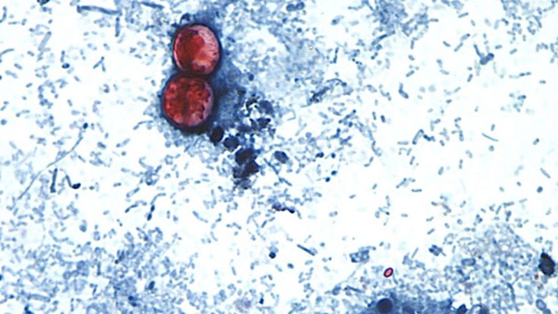 Massive Cyclosporiasis Outbreak Officially Linked to Four More States